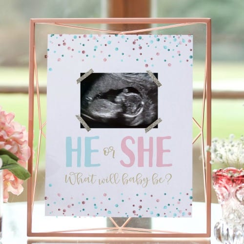 He or She Sonogram Gender Reveal Party Decor